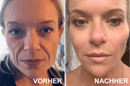✨ V-Face Lifting Tape🪄– Sofortiger Lift-Effekt & straffere Konturen