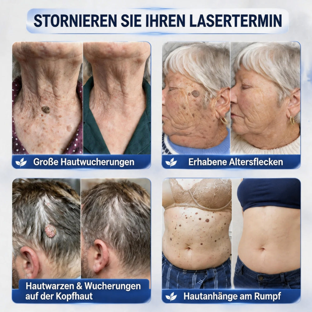 7-Tage-Serumcreme gegen Pickel & Hautflecken