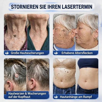 7-Tage-Serumcreme gegen Pickel & Hautflecken