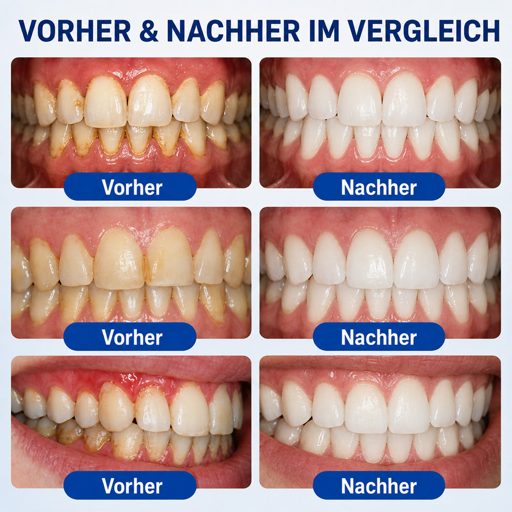 Repariert Zahnschäden in 7 Tagen