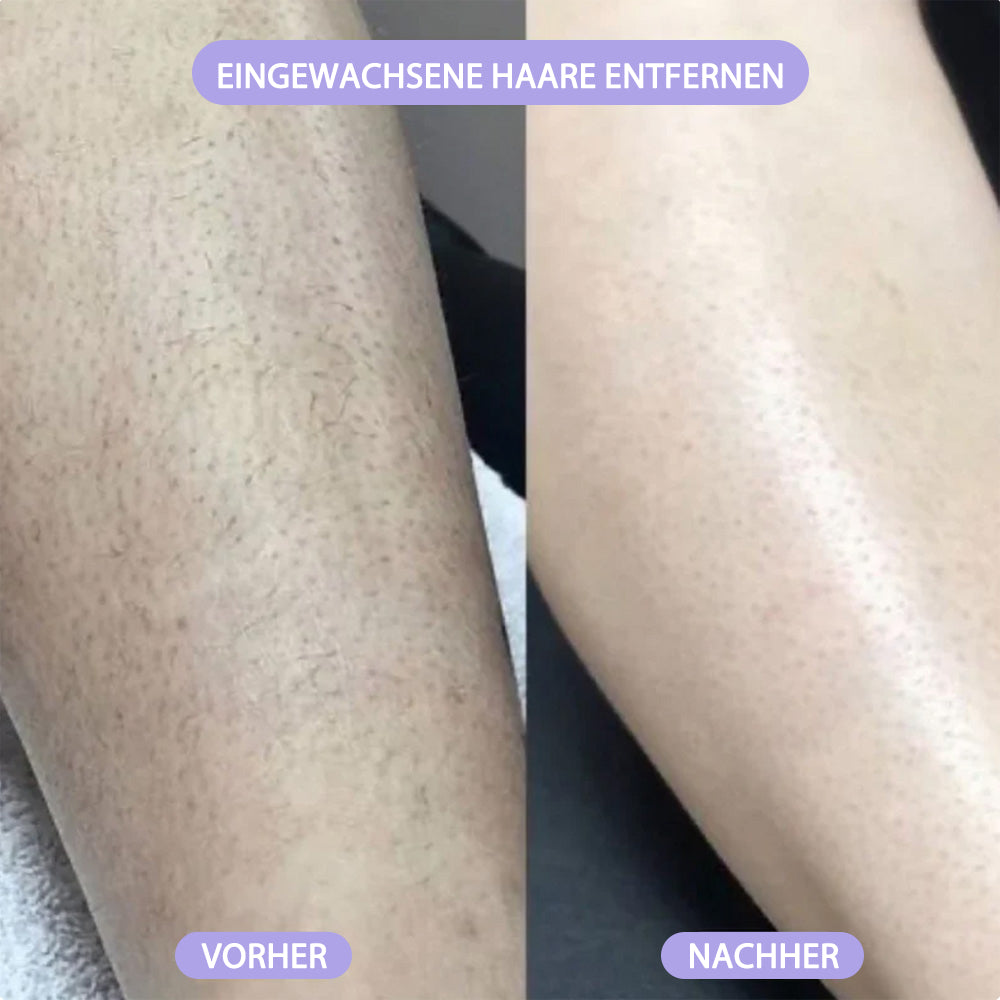 ✨2-in-1 Schmerzfreier Bikini Trimmer für Gesicht & Körper