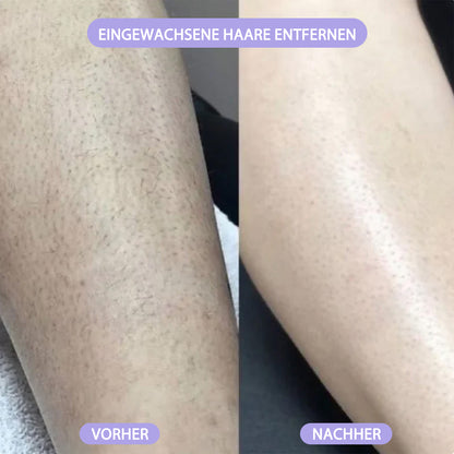 ✨2-in-1 Schmerzfreier Bikini Trimmer für Gesicht & Körper
