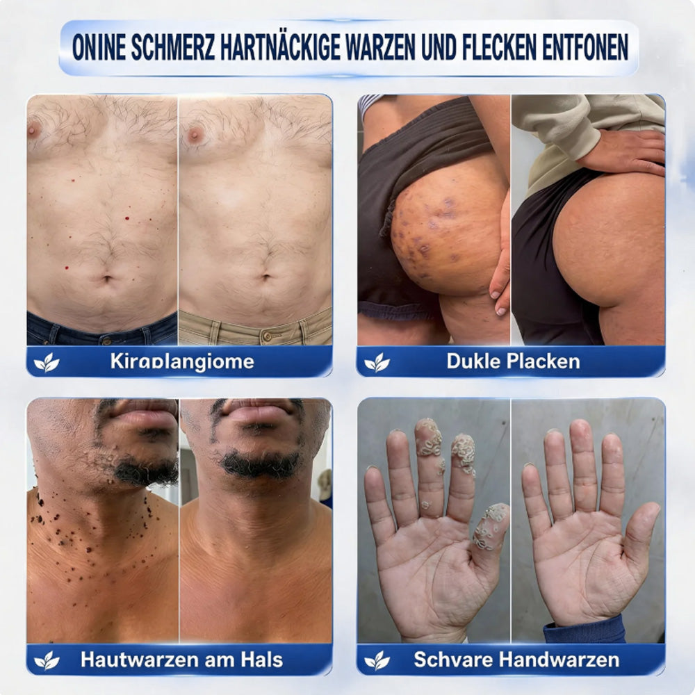 7-Tage-Serumcreme gegen Pickel & Hautflecken