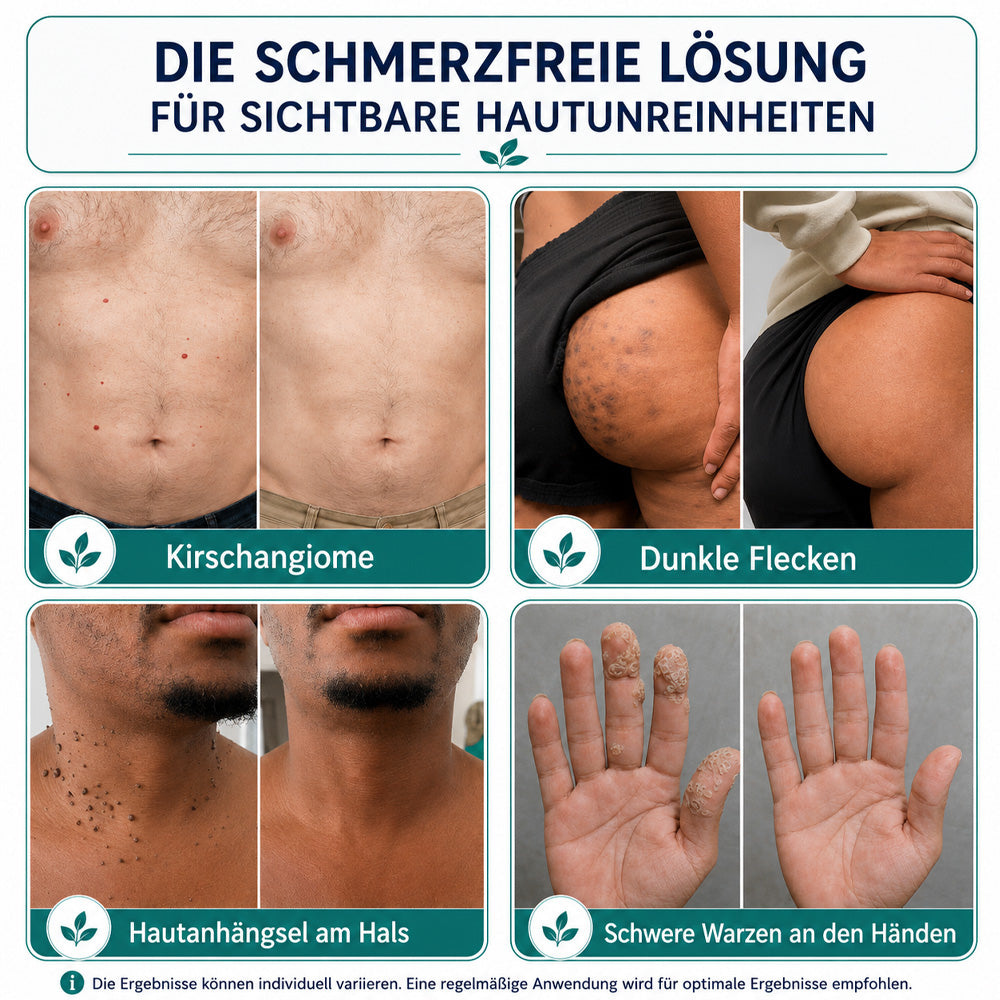 Effektive botanische Mikronadel-Pflaster zur Entfernung von Hautanhängseln