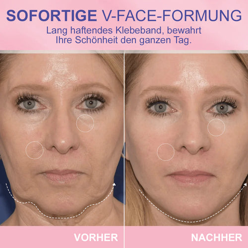 ✨ V-Face Lifting Tape🪄– Sofortiger Lift-Effekt & straffere Konturen