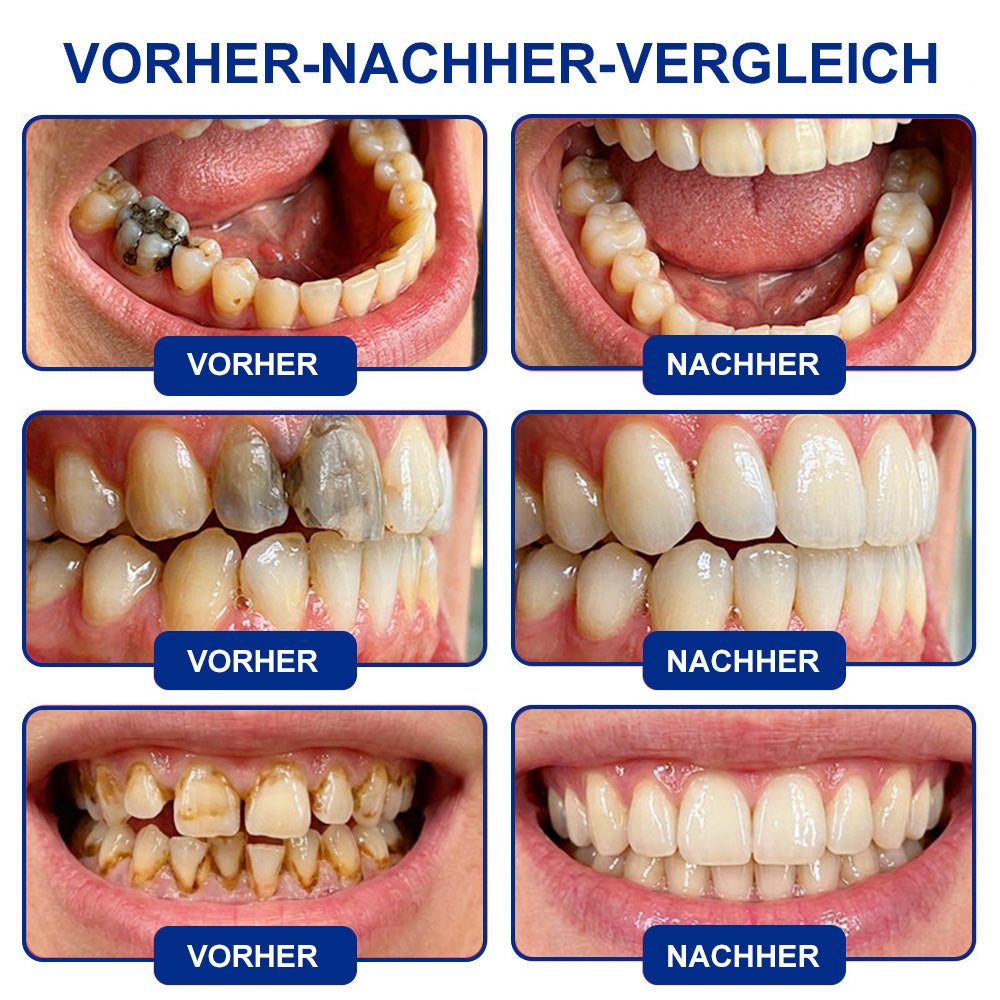 🤍Drefryna® Zahnschmelz-Reparatur Gel