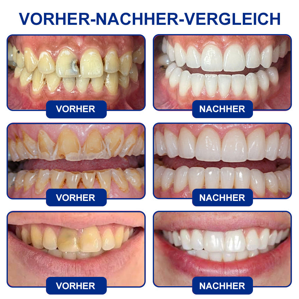 🤍Drefryna® Zahnschmelz-Reparatur Gel