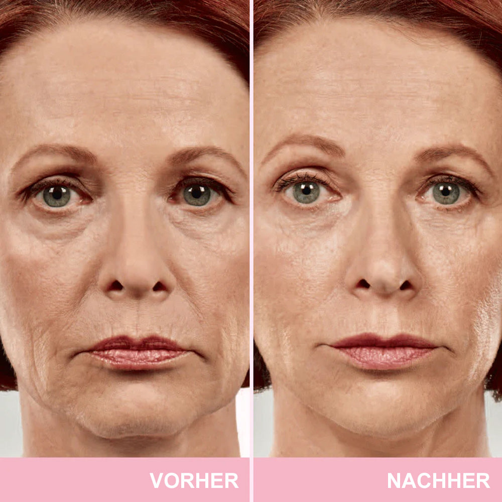 ✨ V-Face Lifting Tape🪄– Sofortiger Lift-Effekt & straffere Konturen