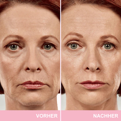 ✨ V-Face Lifting Tape🪄– Sofortiger Lift-Effekt & straffere Konturen