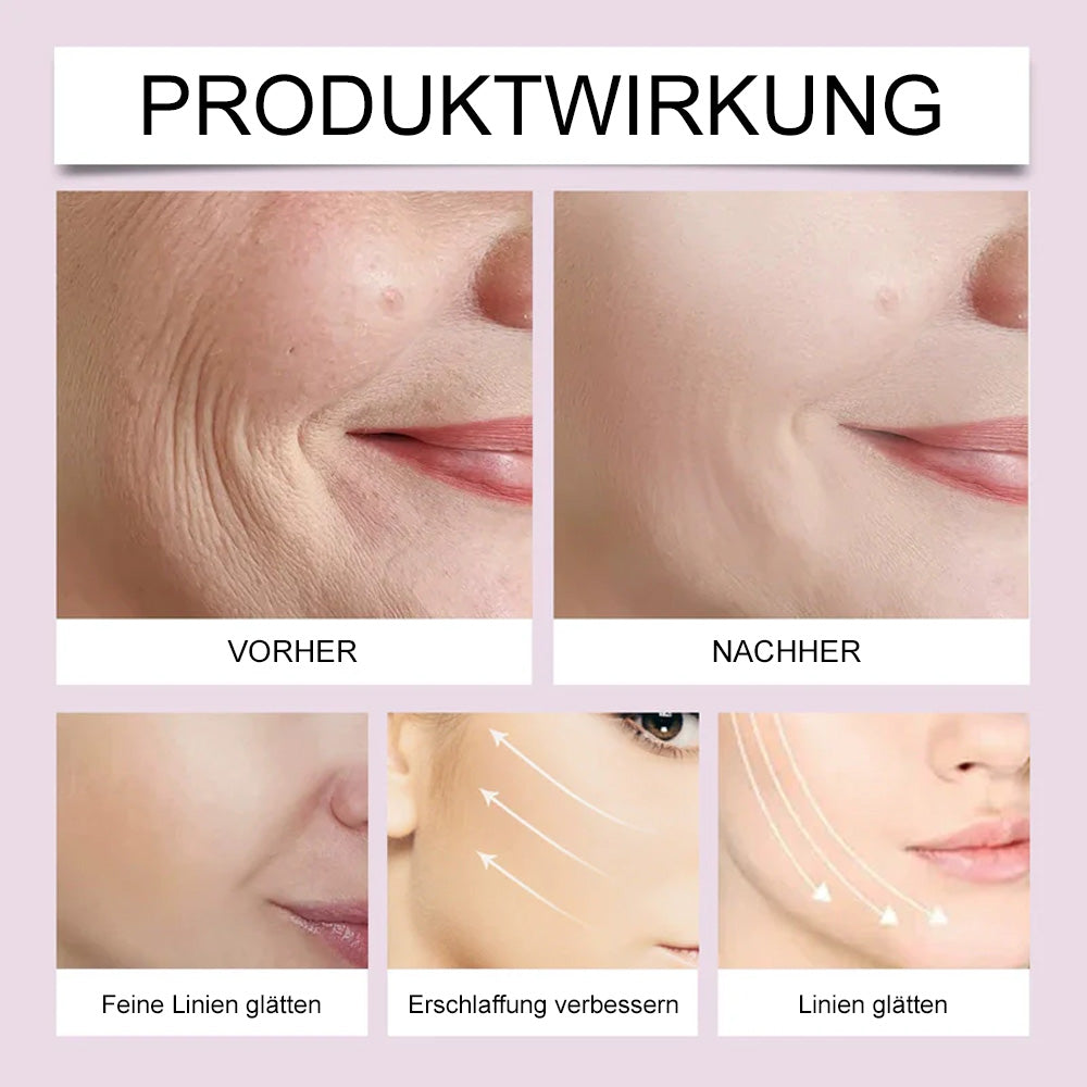 ✨ V-Face Lifting Tape🪄– Sofortiger Lift-Effekt & straffere Konturen