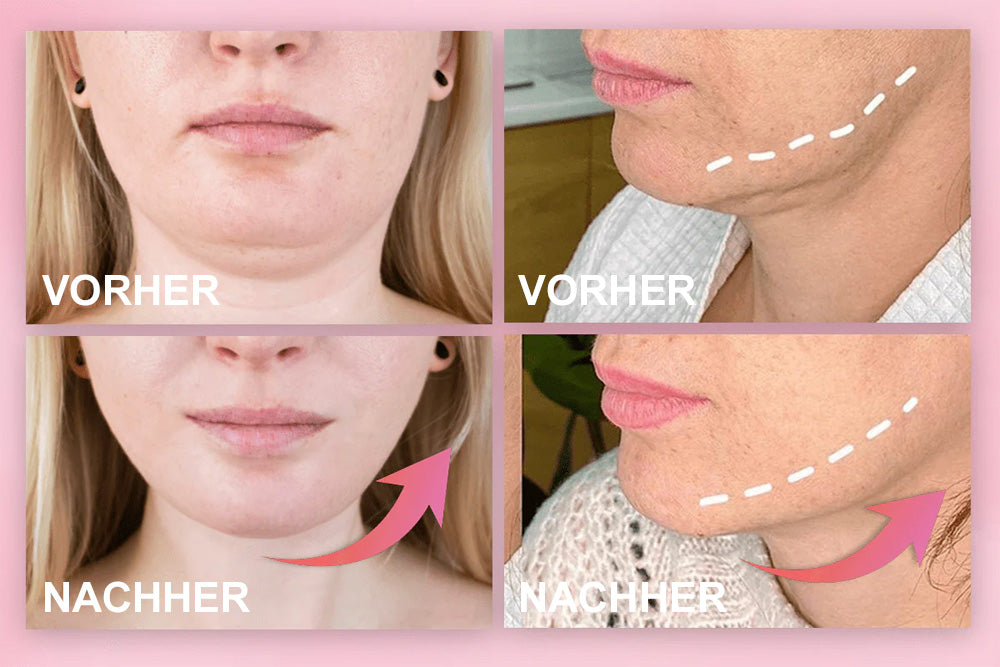 ✨ V-Face Lifting Tape🪄– Sofortiger Lift-Effekt & straffere Konturen